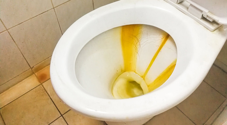 cara membersihkan kerak toilet